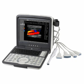 Diagnóstico do Equipamento de ultra-som Hospital de clínicas Doppler colorido ultra-som ginecológico e obstetrícia ultra-sonografia